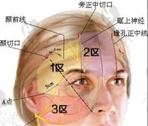 鄭州拉皮醫(yī)生