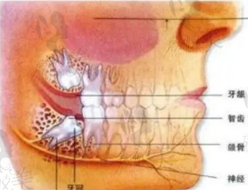 智齿在口腔内的位置