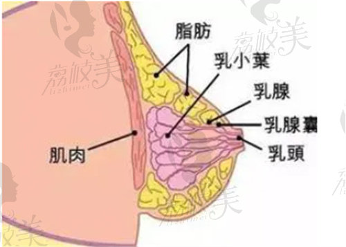 姜宇禄医生做缩胸手术多少钱？