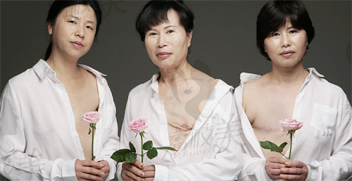 韩国THE整形医院做乳房再造厉害的医生推荐玉在镇院长