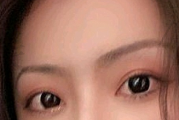 韩国KRISMAS整形外科双眼皮评价2.png