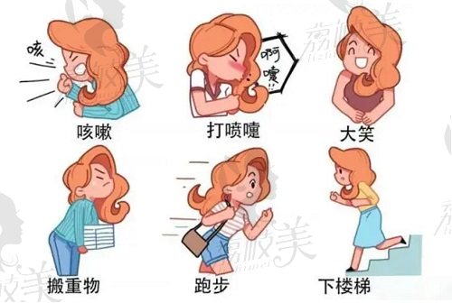 我有做过3d生物束带紧缩术的分享 我有做过3d生物束带紧缩术的分享