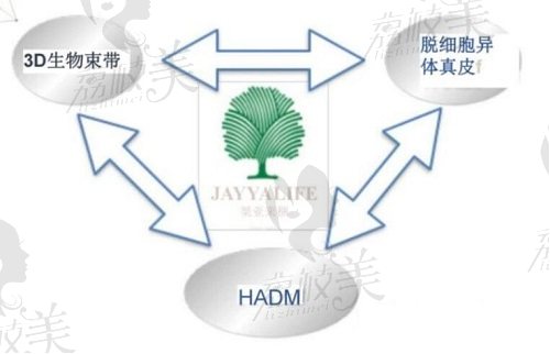 我有做过3d生物束带紧缩术的分享