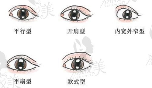 广州地区做双眼皮修复好的医生有哪些