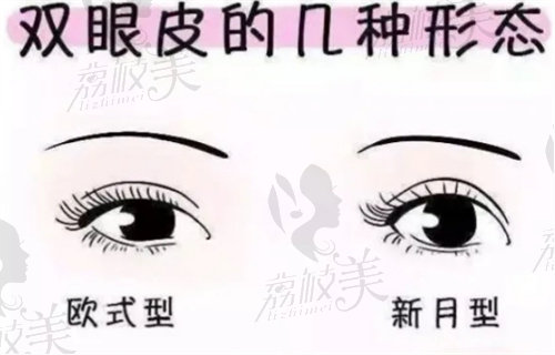 南京艺星吕永全做双眼皮的形态