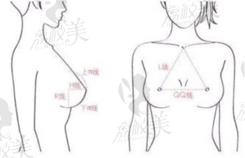邓正军医生做乳房下垂矫正怎么样？