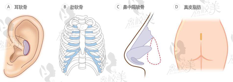 韩国有名的鼻修复医生李奎昊