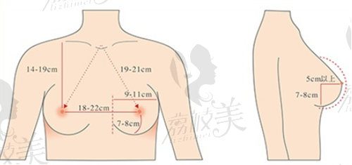 张林宏做假体隆胸技术好