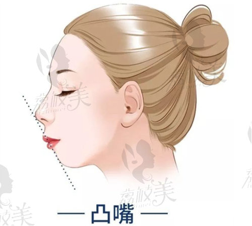 上海时光整形做正颌手术怎么样？