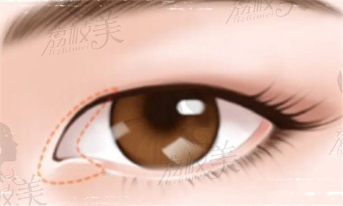 武汉地区有什么比较好的眼修复医生呢