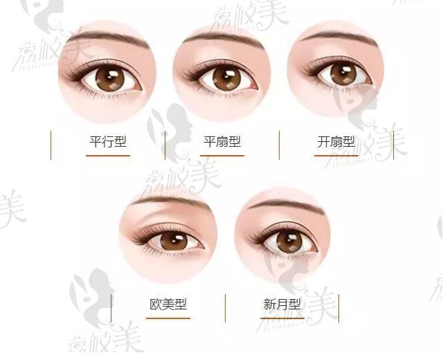 双眼皮