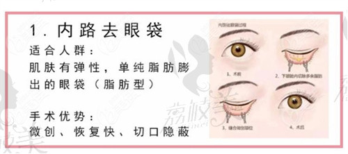 李东亮医生祛眼袋过程模拟2