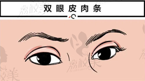 鹿世江医生做双眼皮修复贵不贵？