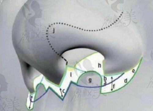 上海韩东亮做人中缩短手术范围