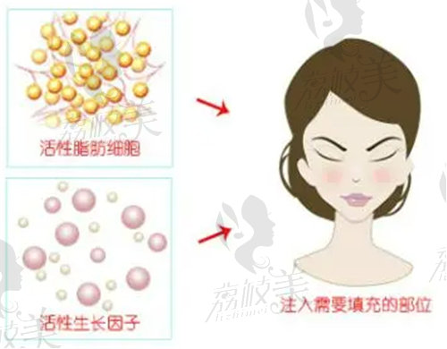 武汉艺星医疗美容医院做面部填充怎么样？
