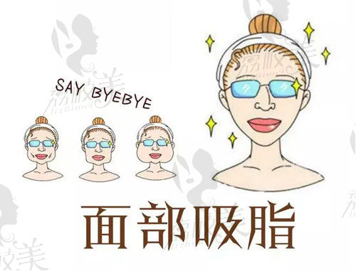 面部吸脂