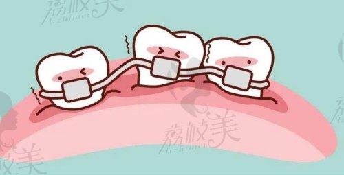 台州牙齿矫正医院排名