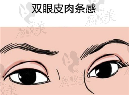 武汉亚韩做双眼皮修复多少钱？