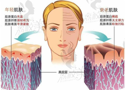 杭州做熱瑪吉比較好的醫(yī)院有哪些？