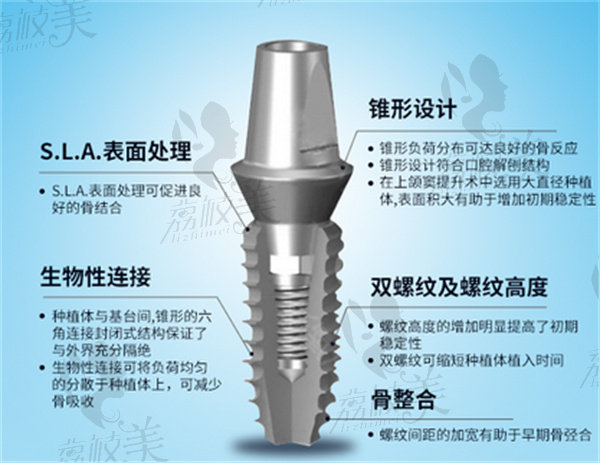 四川种植牙集采什么时候落地的