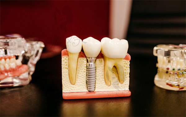 种牙加骨膜骨粉是不是忽悠？