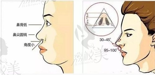 珠海熙尔曼曾举双超鼻综合有哪些优势？