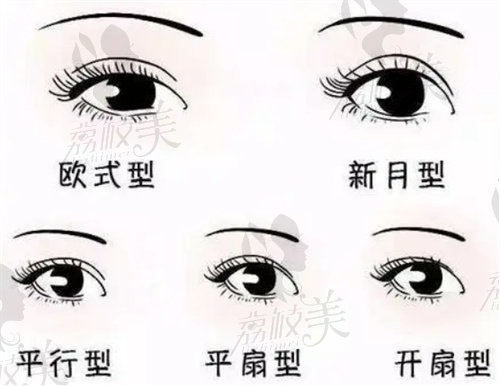 双眼皮类型图