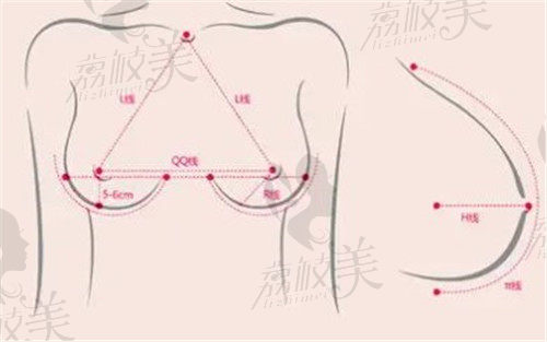 合肥王明剛醫(yī)生隆胸怎么樣