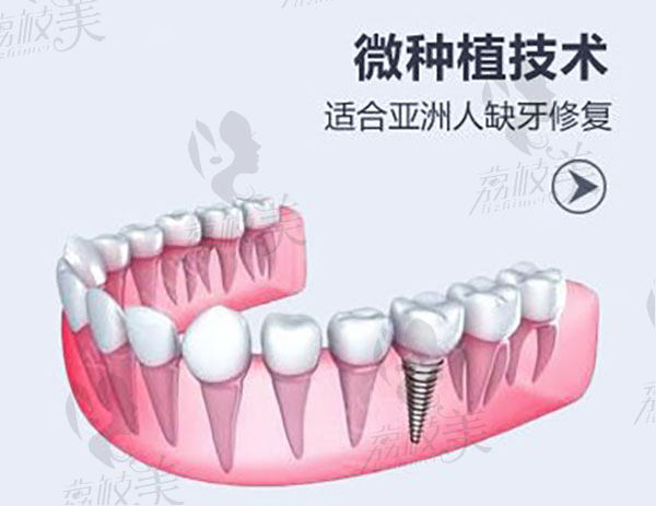 廣州穗華口腔醫(yī)院