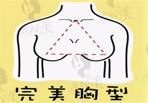 隆胸后的胸型图