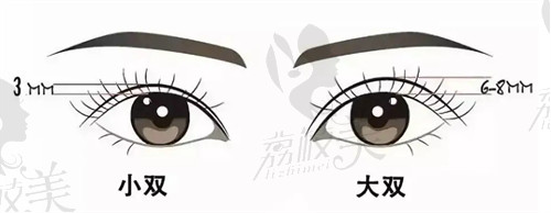 南京美贝尔黄名斗做眼睛的技术如何
