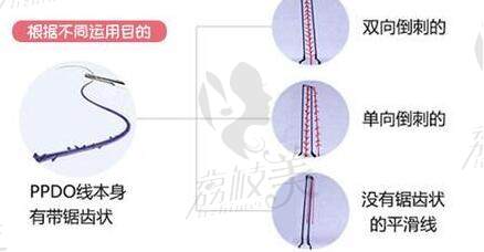 意大利悦升线和强生鱼骨线哪个好