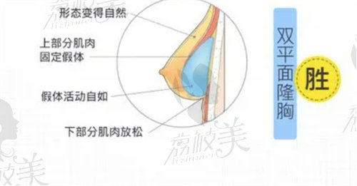 重慶華美陳德法豐胸好不好？