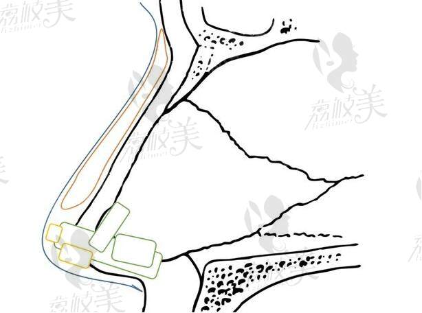 宮風(fēng)勇做鼻子是啥風(fēng)格