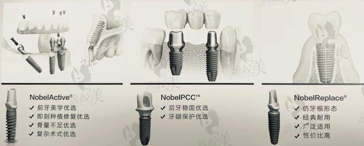 北京美莱口腔种植牙多少钱