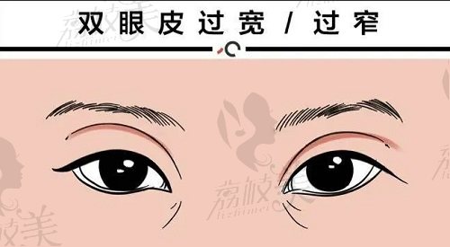 郑州壹加壹张丹阳医生玖度眉眼双眼皮技术
