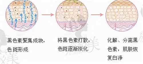 上海做超皮秒的价格是多少？