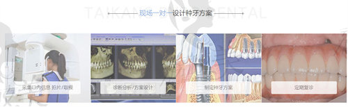 术前选择合适的植体并制定专属方案