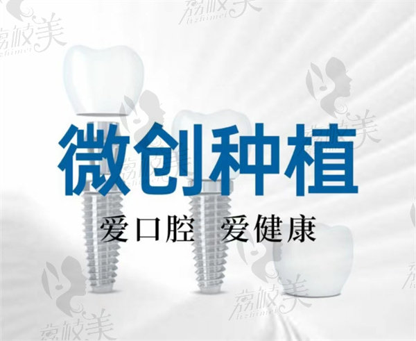 杭州整形医院口腔科种植牙