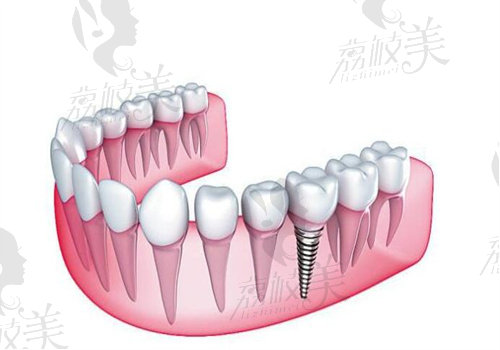 张震医生擅长种植牙