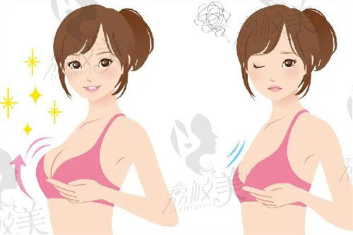朱京成医生曼托圆盘光面假体隆胸技术优势