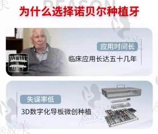 为什么选择诺贝尔种植牙