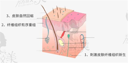 深圳曹孟君醫(yī)療吸脂立體緊致