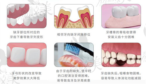 海口微笑口腔醫(yī)院看牙價格是多少