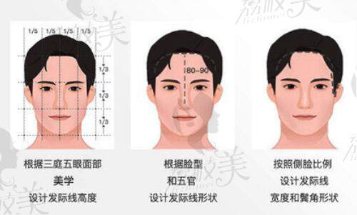 廣州植發(fā)正規(guī)醫(yī)院排名前十位