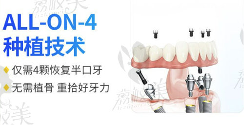 廣州穗華口腔醫(yī)院進(jìn)口種植牙多少錢一顆