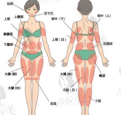 西安窦玺吸脂好还是王仁根抽脂技术好？