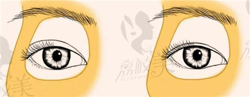 上海艺星许炎龙做眼修复技术怎么样？