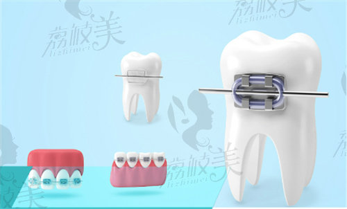 兰州皓亚口腔医院收费标准