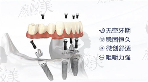 兰州皓亚口腔医院拔一颗牙多少钱